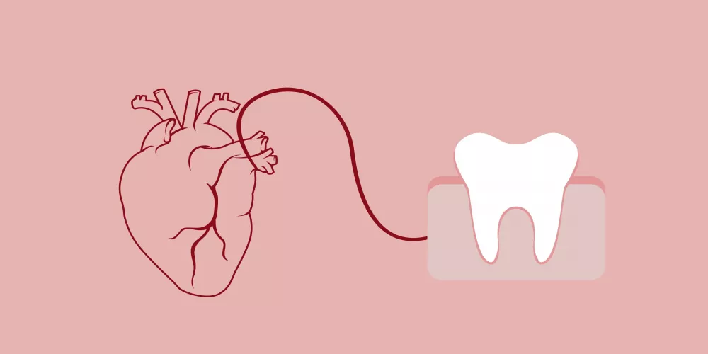 مشكلات القلب... متى يكون سببها آلالام الأسنان؟